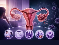 What happens if ovarian cancer relapses? 5 things doctors want you to know about protecting ovarian health