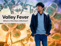 37-year-old Indian techie dies in California after rare fungal infection damaged his lungs: What is Valley fever and how dangerous is it?