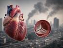 Valvular heart disease patients face greater health risks from air pollution, study finds