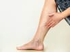 Long hours on your feet may trigger varicose veins