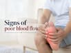 Vascular disease symptoms: 10 early warning signs of poor circulation you should never ignore