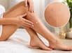Vitamin D deficiency symptoms: 6 warning signs your skin may show when vitamin D levels drop too low