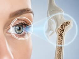 Weak bones might leave signs in your eyes, study suggests