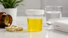 5 reasons why your urine turns bright yellow after taking vitamins