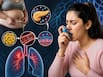 मोटापा और इंसुलिन रेजिस्टेंस बढ़ा सकते हैं Asthma का खतरा, रिसर्च में खुलासा