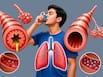 नॉर्मल फेफड़े और अस्थमा वालों के फेफड़ों में क्या फर्क है? जानिए अस्थमा में फेफड़े कैसे बदल जाते हैं