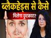 ब्लैकहेड्स हटाने के टिप्स, जानें कारण और स्किन को साफ रखने का तरीका!