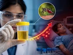 अब यूरिन टेस्ट बताएगा कितना गंभीर हो सकता है डेंगू और आपको अस्पताल में भर्ती होने की जरूरत है या नहीं