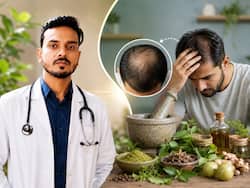 बाल झड़ने की समस्या को दूर करने के लिए आयुर्वेद पर ज्यादा भरोसा क्यों करते हैं लोग?