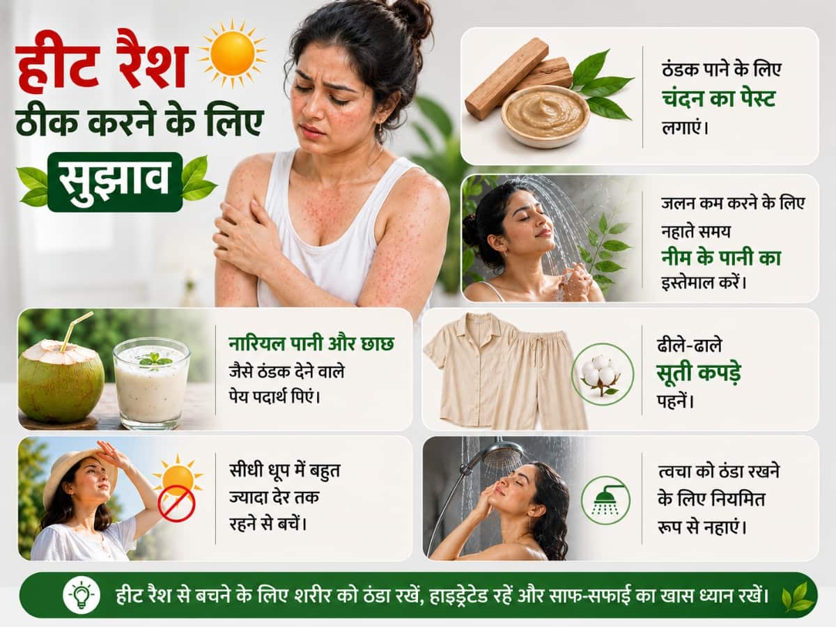 हीट रैश कैसे ठीक करें?