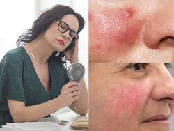 हॉट फ्लैशेस क्या हैं? 45+ महिलाओं में क्यों दिखते हैं इसके लक्षण