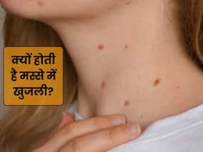क्या मस्से में खुजली होना नॉर्मल है? डॉक्टर से जानें कारण और इलाज