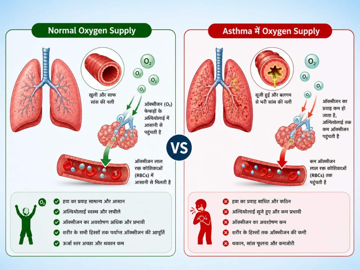oxygen supply