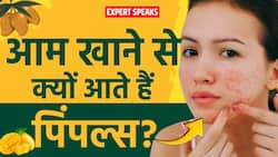 आम खाने से होते हैं पिंपल्स? मुँहासों की सच्चाई, सुरक्षित मात्रा और स्किन की देखभाल के बीच क्या है Relation?