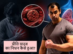 Prateek Yadav Death Reason: क्या है पल्मोनरी एम्बोलिज्म? डॉ. ने बताया प्रतीक यादव को कुछ दिन पहले हुई थी ये बीमारी