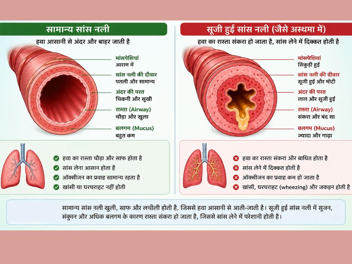 respiratory tube