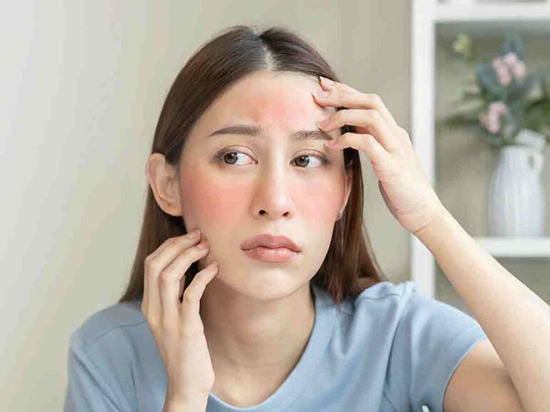 गर्मियों में चेहरे पर बर्फ लगाने से क्या होता है?