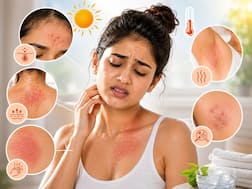 गर्मियों में पसीने से होने वाली 5 स्किन प्रॉब्लम्स और उनसे बचने के उपाय, एक्सपर्ट से जानें