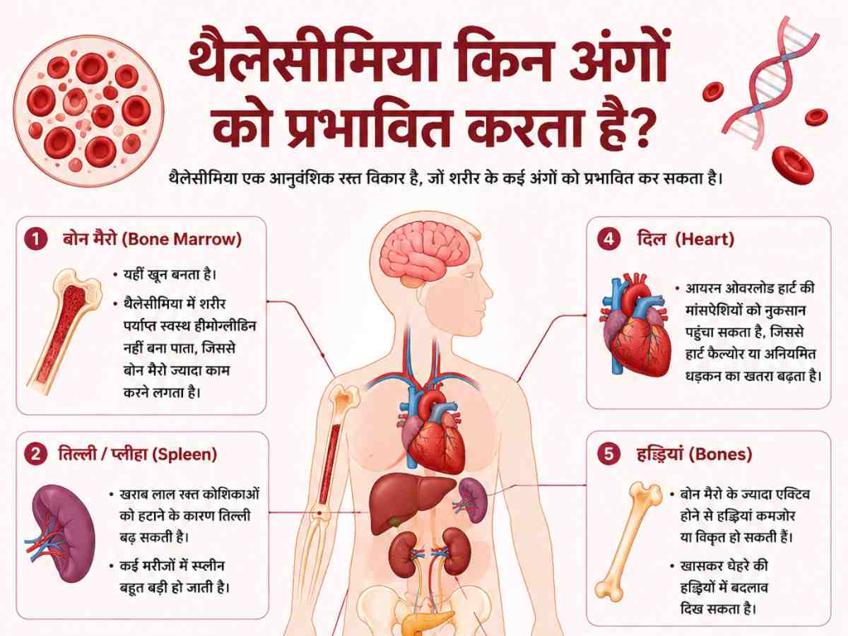 थैलेसीमिया किस अंग को प्रभावित करता है?
