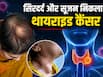 सिर में सूजन और दर्द को सामान्य समझ रही थी महिला, टेस्ट में निकला थायराइड कैंसर, जानें कब दिखता है यह Rare संकेत