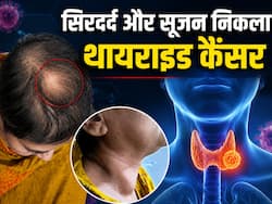 सिर में सूजन और दर्द को सामान्य समझ रही थी महिला, टेस्ट में निकला थायराइड कैंसर, जानें कब दिखता है यह Rare संकेत