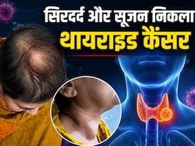 सिर में सूजन और दर्द को सामान्य समझ रही थी महिला, टेस्ट में निकला थायराइड कैंसर, जानें कब दिखता है यह Rare संकेत