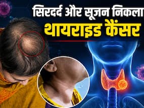 सिर में सूजन और दर्द को सामान्य समझ रही थी महिला, टेस्ट में निकला थायराइड कैंसर, जानें कब दिखता है यह Rare संकेत सिर में सूजन और दर्द को सामान्य समझ रही थी महिला, टेस्ट में निकला थायराइड कैंसर, जानें कब दिखता है यह Rare संकेत