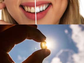 इस विटामिन की कमी से पीले हो सकते हैं दांत, Teeth Whitening के लिए अपनाएं ये टिप्स