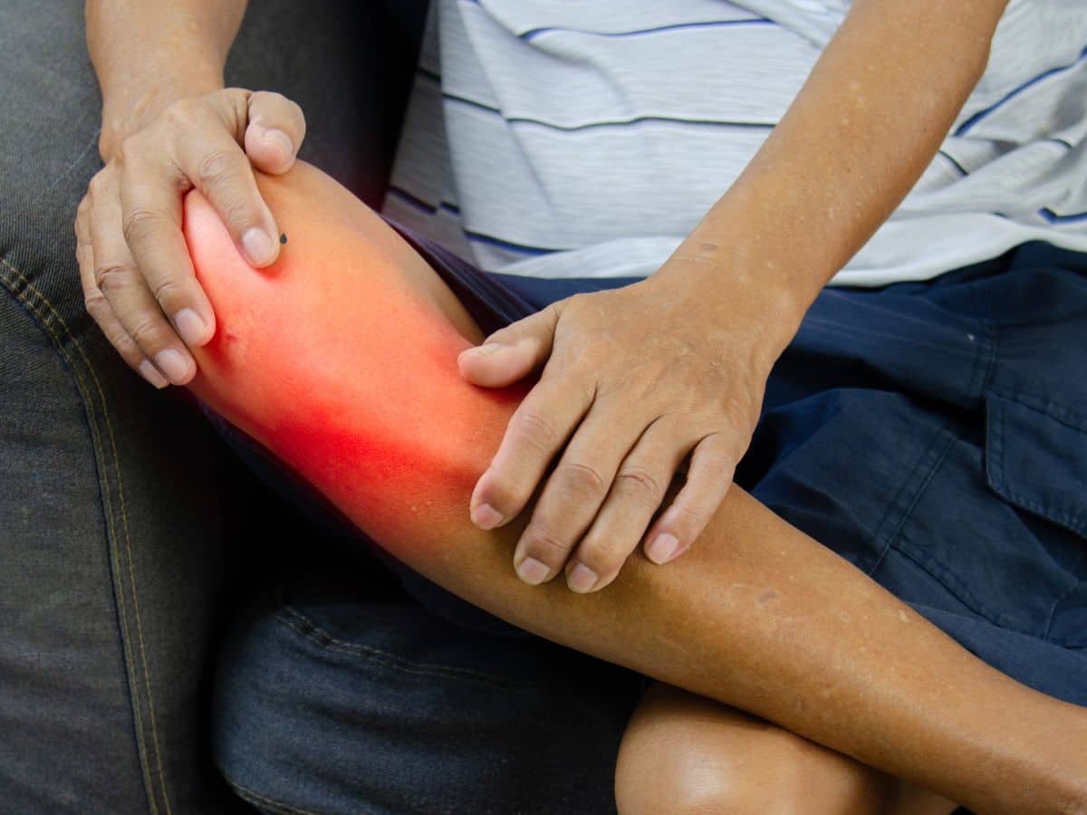 ACL injury