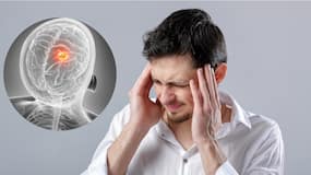 Recurring headaches? Not every severe headache is a migraine: Neurosurgeon explains when to worry about a brain tumour