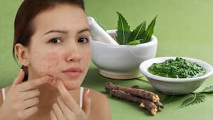 Neem health benefits: Can eating neem leaves during monsoon help treat acne and other skin problems?