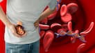 Swollen feet, fatigue and changes in urination: Signs diabetes and high blood pressure have completely damaged your kidneys