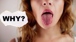 Dry eyes and dry mouth could be signs of an autoimmune disease: What are the 5 warning signs to look out for?