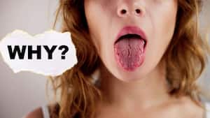 Dry eyes and dry mouth could be signs of an autoimmune disease: What are the 5 warning signs to look out for?