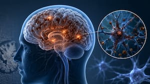 Excess iron in the brain may raise Alzheimer’s and Parkinson’s risk, study warns