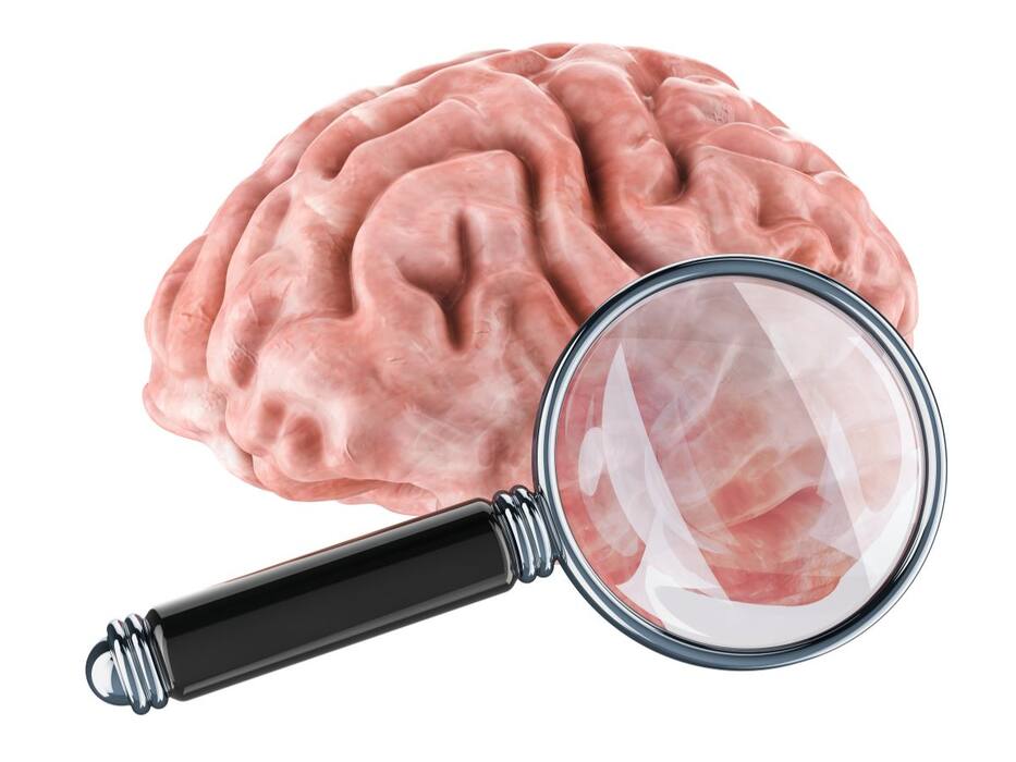 5 silent causes of brain aneurysm you should never ignore