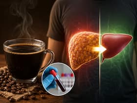 'Black coffee reversed my fatty liver': Man claims SGPT levels improved in 100 days, expert explains how it may help | WATCH