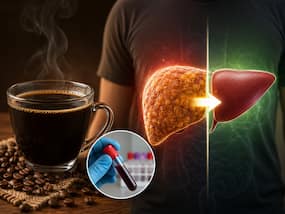 'Black coffee reversed my fatty liver': Man claims SGPT levels improved in 100 days, expert explains how it may help | WATCH