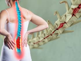 Osteoporosis in men under 50: Persistent back pain, stress fracture and other signs of weak bones that could signal a serious problem