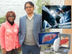 HIV और लिवर कैंसर से जूझ रहे मरीज को मिला नया जीवन, सफल हुआ लिवर ट्रांसप्लांट