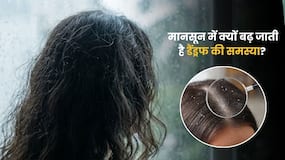 मानसून में क्यों बढ़ जाती है डैंड्रफ की समस्या? जानिए किन लोगों को रहता है सबसे ज्यादा खतरा