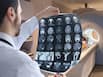 Not every headache needs an MRI: Neurologist explains when you need an MRI and the warning signs you should never ignore