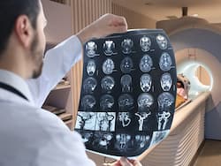 Not every headache needs an MRI: Neurologist explains when you need an MRI and the warning signs you should never ignore