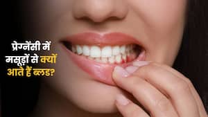 प्रेग्नेंसी के दौरान मसूड़ों से खून आना क्यों बढ़ जाता है?