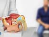 Prostate cancer care in India: Experts explain the latest advances in robotic surgery, AI and precision medicine
