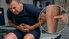 Pancreatic cancers symptoms: Unexplained swelling with pain and 5 other warning signs in your legs you should never ignore