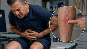 Pancreatic cancers symptoms: Unexplained swelling with pain and 5 other warning signs in your legs you should never ignore