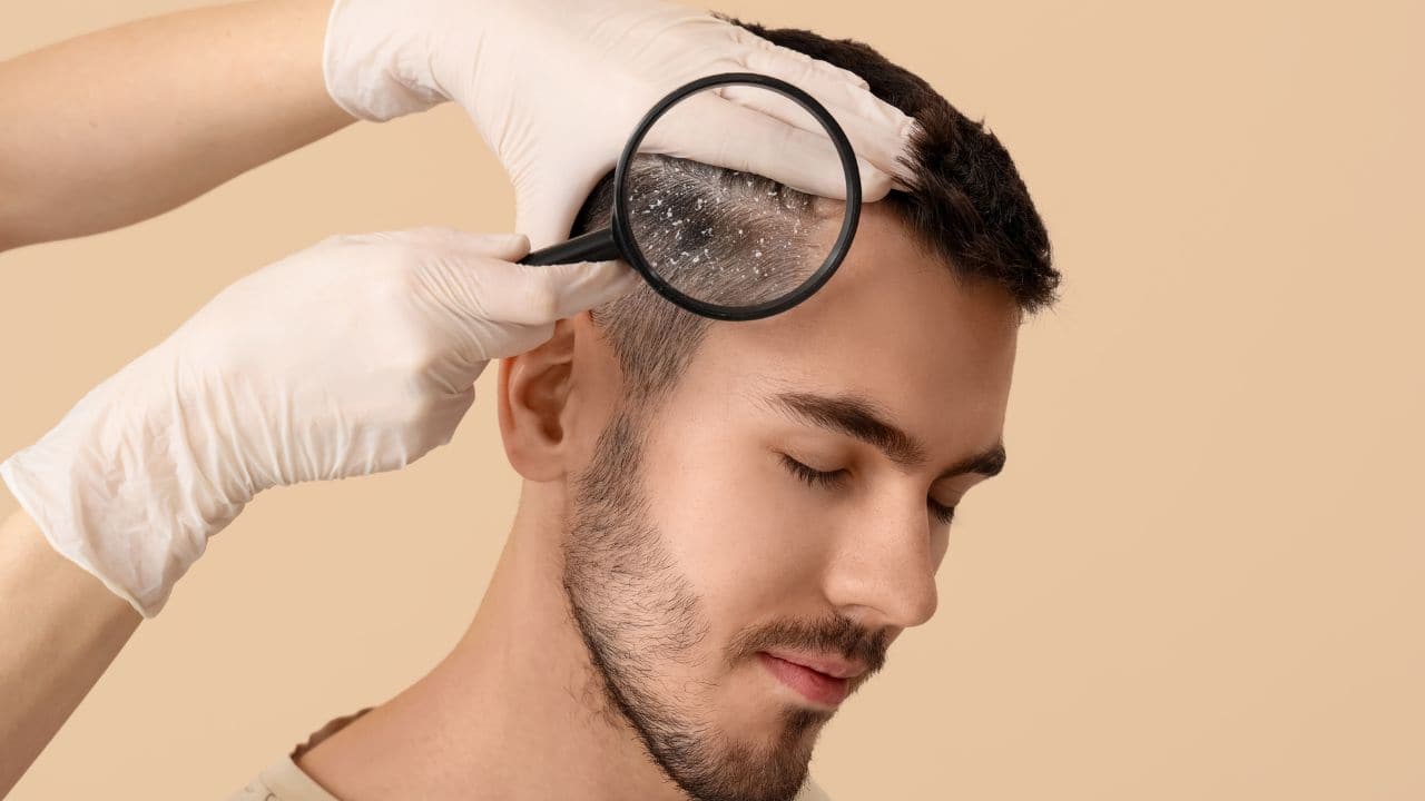 Swet in Scalp