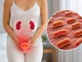Antidiabetic drugs reduce urinary E. Coli biofilms: Why this matters