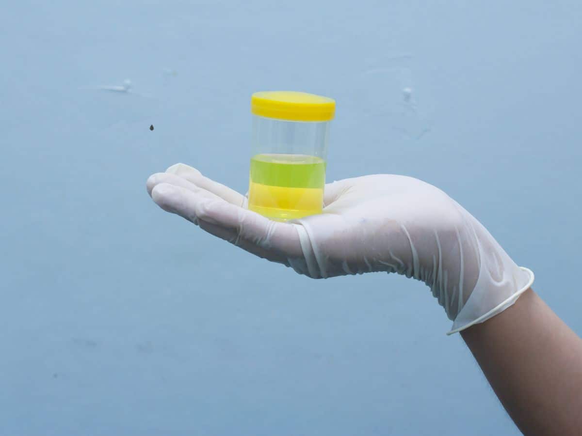 Urine Color